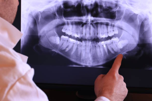 Best Emergency Root Canal Therapy in Stonewall, LA