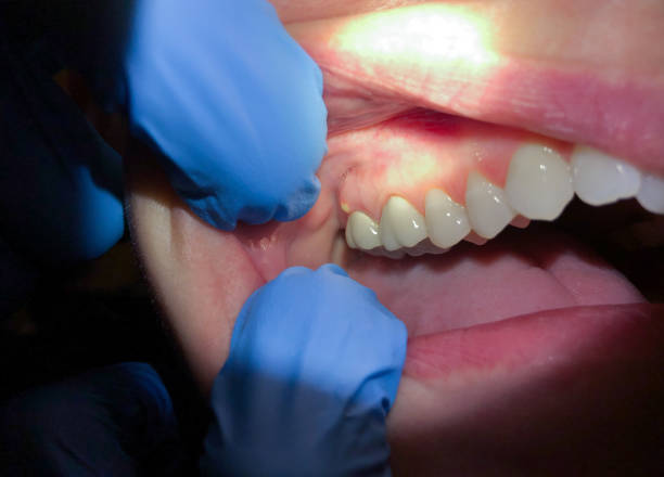 Best Emergency Treatment for Jaw Pain or Injury in Stonewall, LA